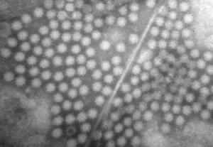 ノロウイルスの電子顕微鏡写真